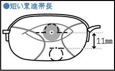 ●短い累進帯長