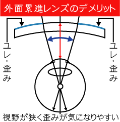 外面累進レンズのデメリット